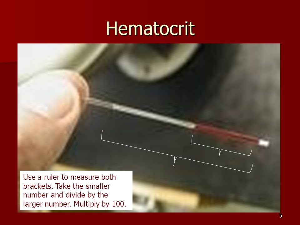 Hematocrit hgt lab report